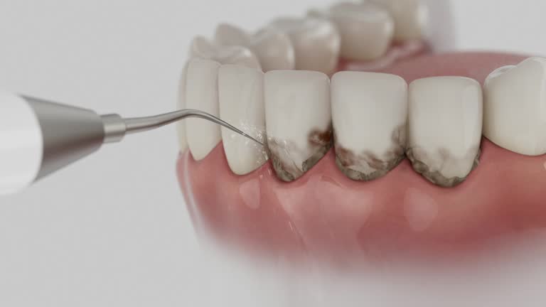 Reliable Teeth Cleaning And Checkup contractor in Stanly County County, NC by Dentist Open Now